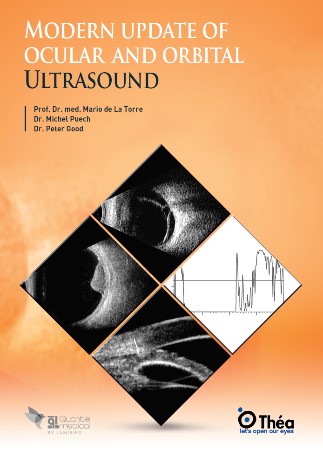 Mod_Update_Ocular___Orbital_Ultrasound